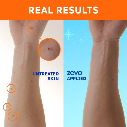 On-Body Mosquito and Tick Repellent Pump Spray (5.9 oz) - Image 2